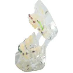 Model stomatologiczny szczęka zęby zębów aparat ortodontyczny-5907451369210