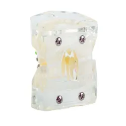 Model stomatologiczny szczęka zęby zębów aparat ortodontyczny-5907451369210