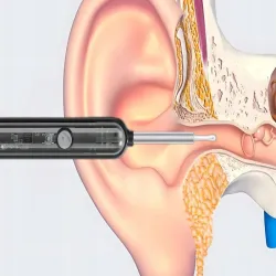 Endoskop otoskop z kamerką wifi zestaw narzędzi do czyszczenia uszu-5907451373224