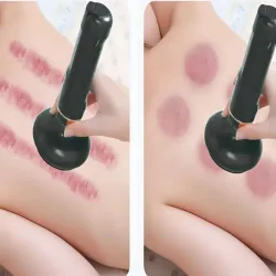 Bańka chińska masażer elektryczny 6 mocy zassysania bańki i olejek-5907451364406