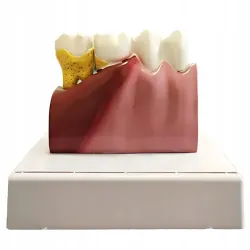 Model anatomiczny zęba stomatologiczny edukacyjny przekrój poglądowy-5907451376447