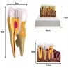Model anatomiczny zęba stomatologiczny edukacyjny przekrój poglądowy-5907451376447
